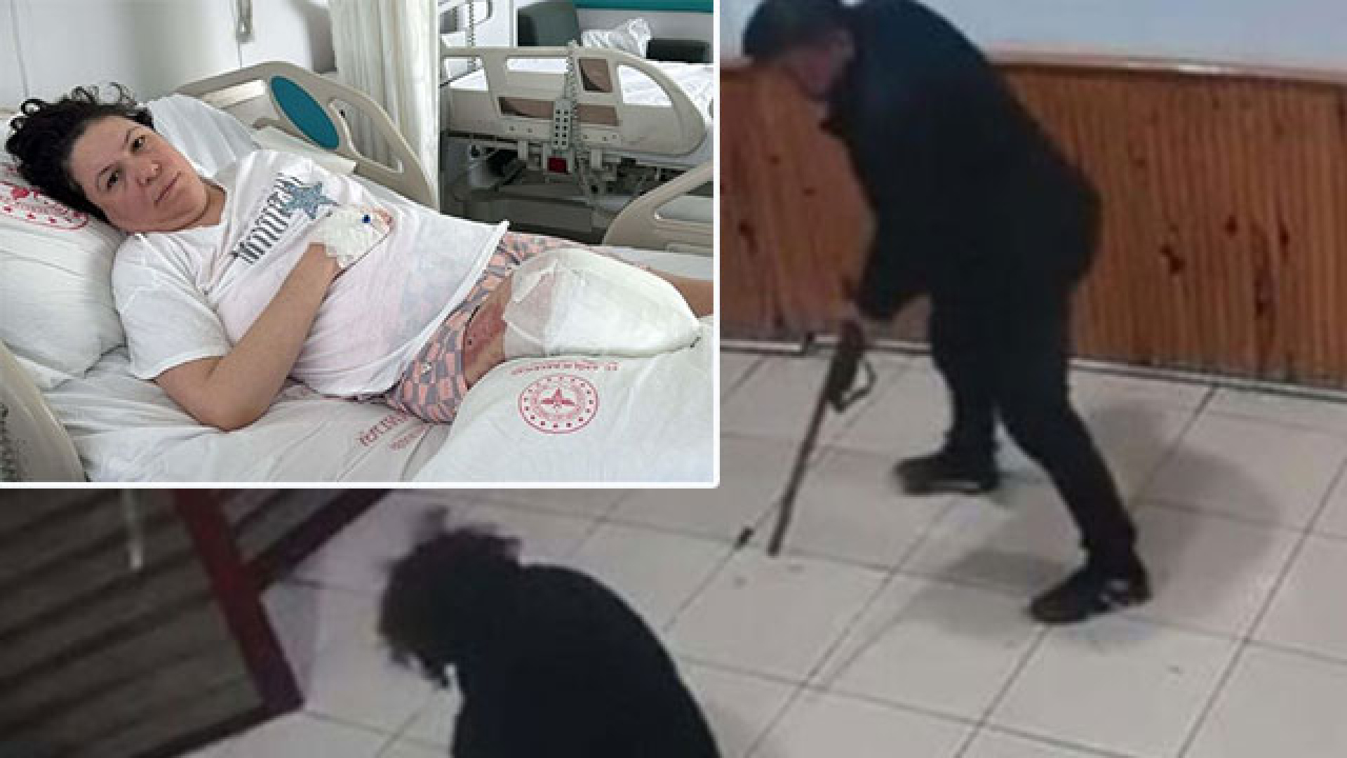 Eşinin saldırısında sol bacağını kaybetmişti! Bir acı haber daha geldi