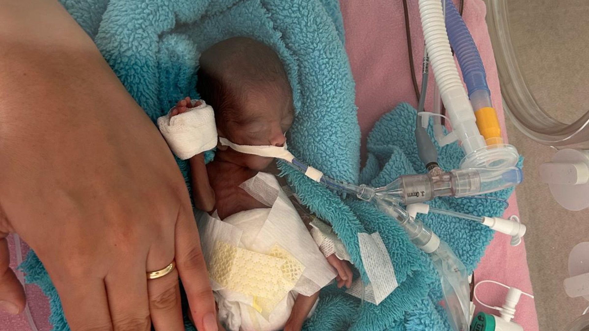 350 gram doğmuştu! Rüzgar bebek 240 gün sonra yaşam mücadelesini kazandı
