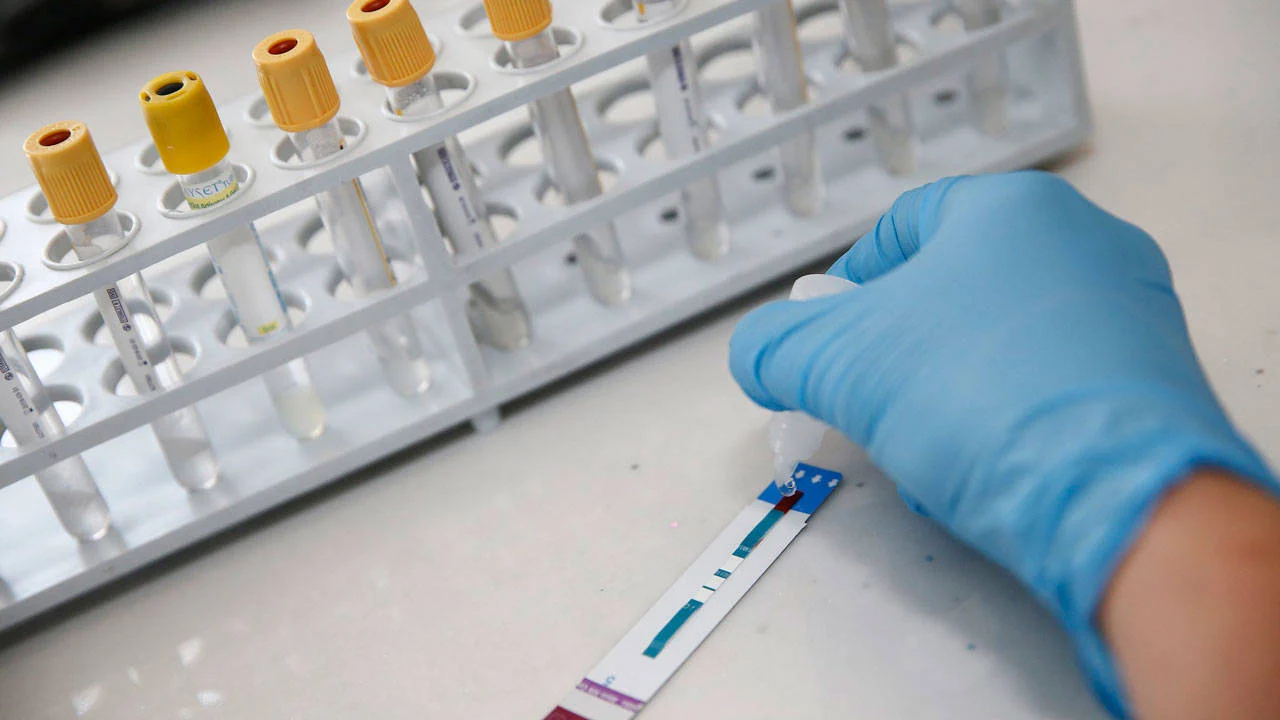 Fiji'de HIV nedeniyle "ulusal kriz" ilan edildi
