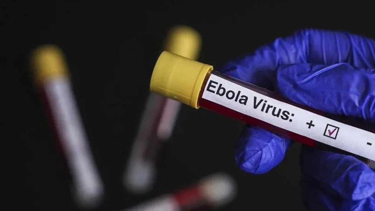 DSÖ, Kongo'da Ebola bulaşan 10 bini aşkın kişinin neredeyse yarısının öldüğünü bildirdi
